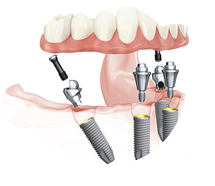 烟台口腔综合诊治