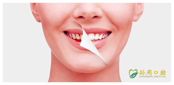牙齿美白