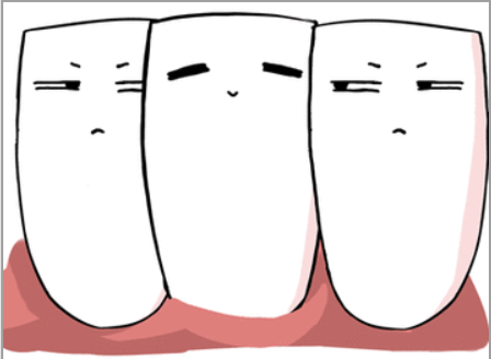 正常牙齿松动度