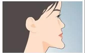 要不要早期矫治？你的决定会改变孩子的一生