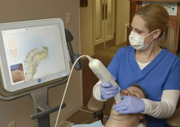 孙周口腔重磅引进iTero智能口内扫描仪！邀您体验全球顶尖牙齿矫正黑科技