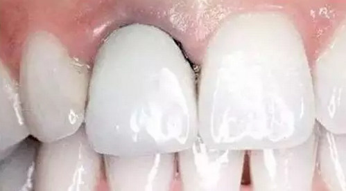 烟台口腔牙齿修复