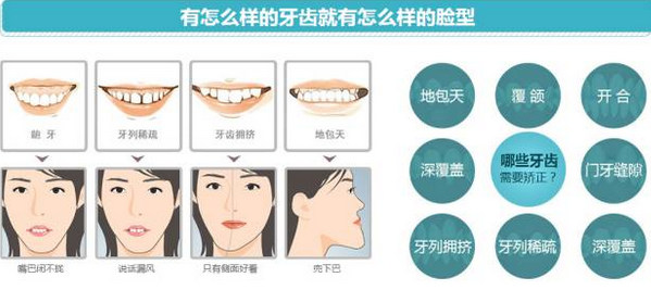 你真的了解y烟台隐形矫正吗