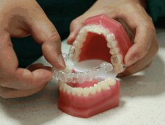 烟台牙齿隐形矫正疑问解答