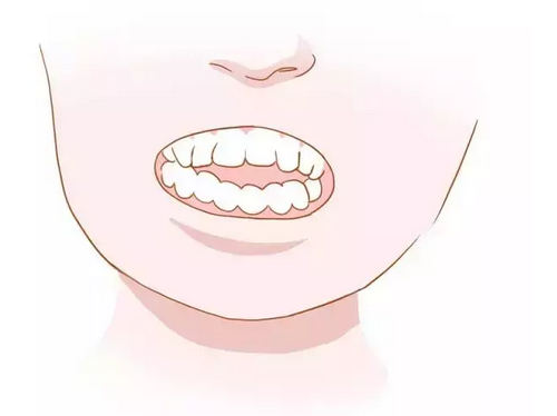 烟台隐形矫正开合