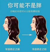 3.8女神节特惠｜优“牙”女神节，“齿”刻你最